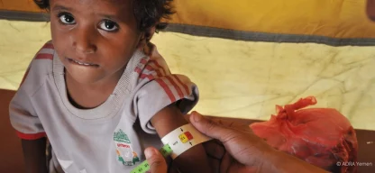 Einem Kind im Jemen wird der Oberarm mit einem Maßband abgemessen. In der anderen Hand hält das Kind einen Erdnussriegel.